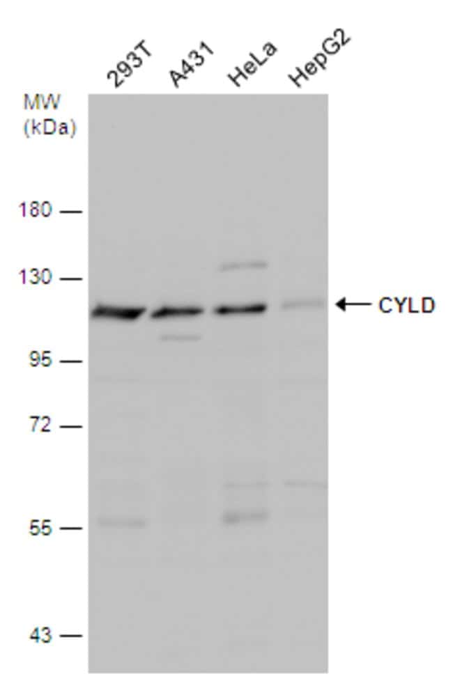 Anti-Cylindromatosis 1