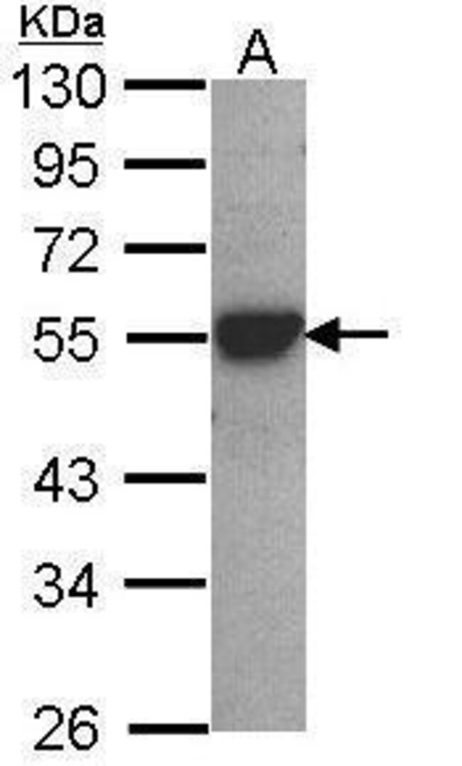 Anti-Cytochrome P450 2D6