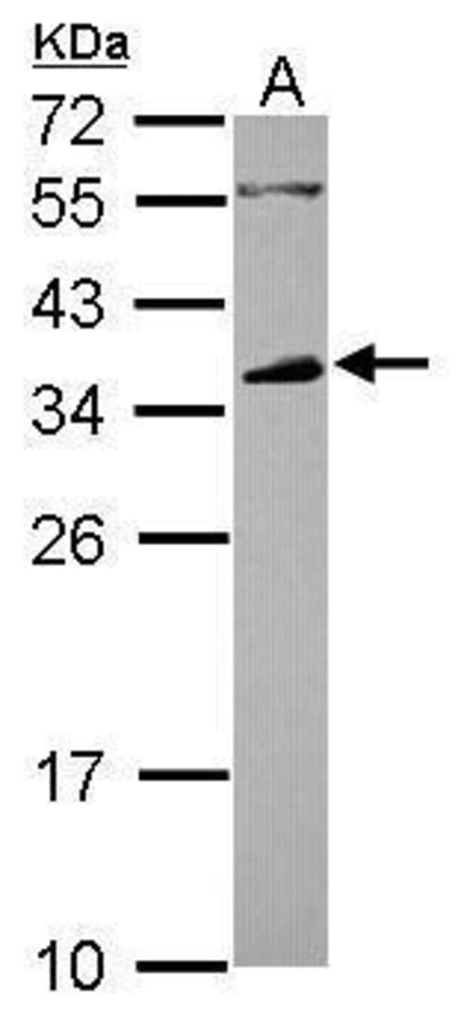 Anti-CD32B