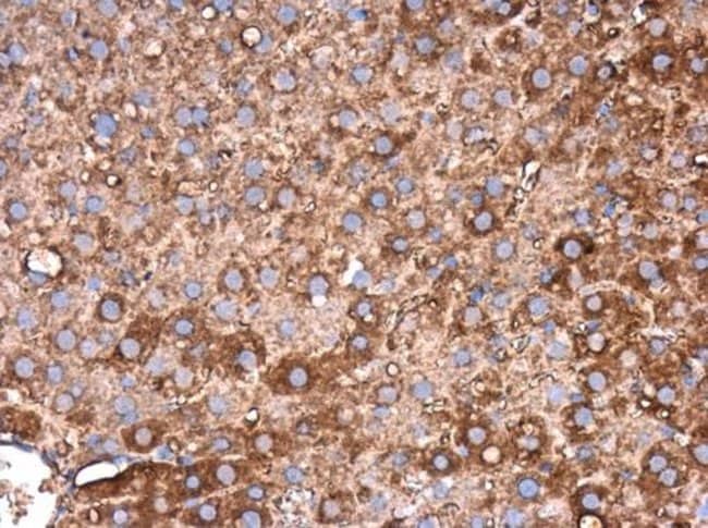 Anti-Fibrinogen beta