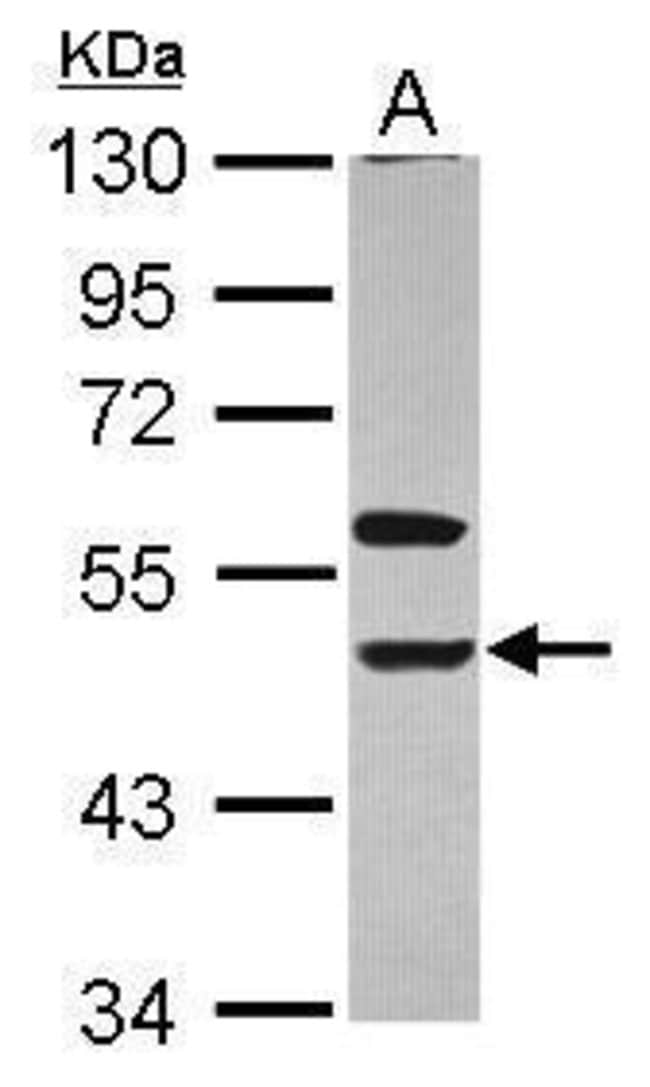 Anti-KIR3DL1