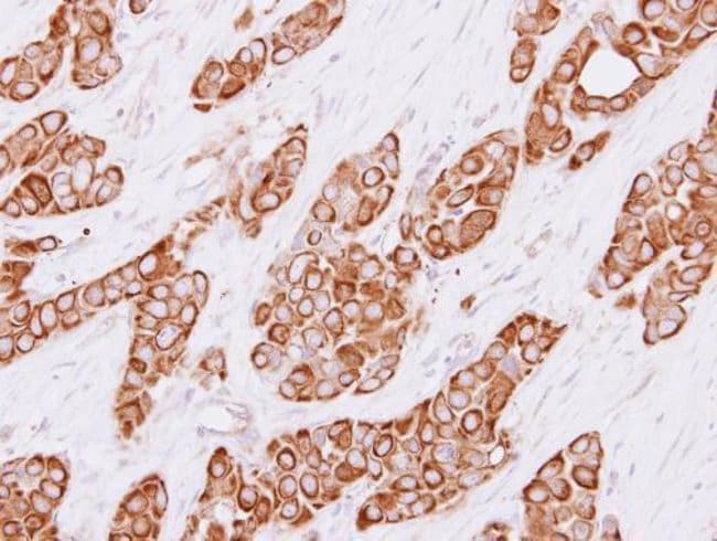 Anti-Cytokeratin 4