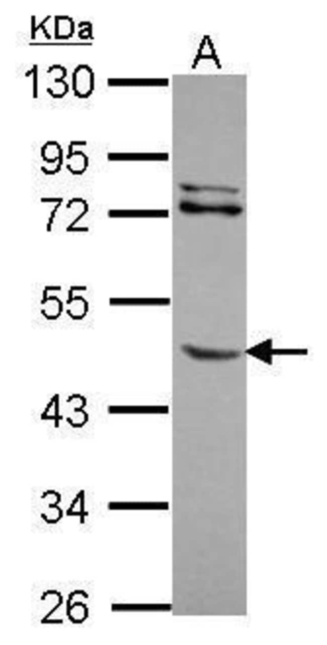 Anti-MMP8