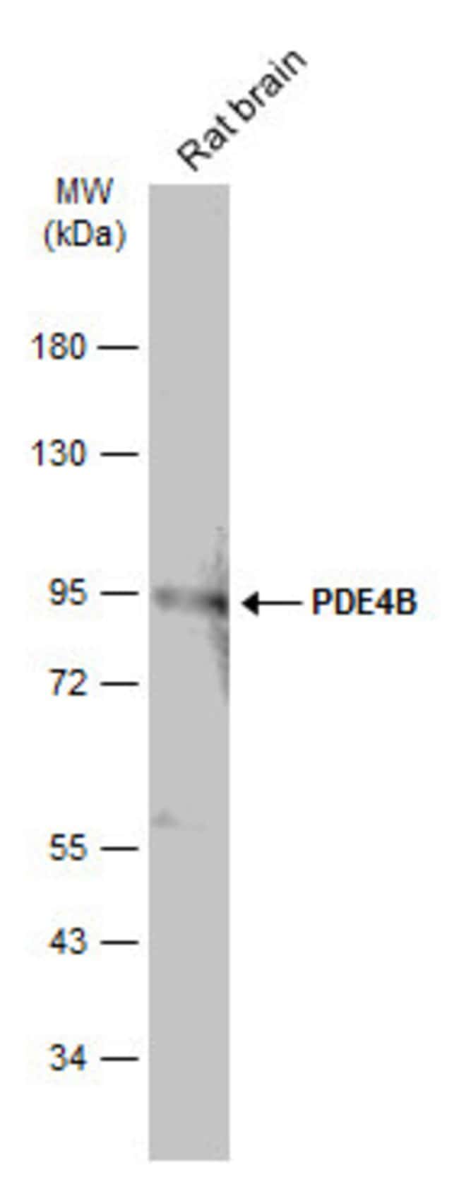 Anti-PDE4B