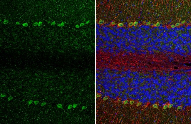 Anti-TRPC6