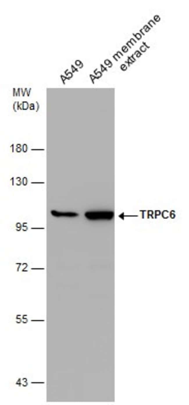 Anti-TRPC6