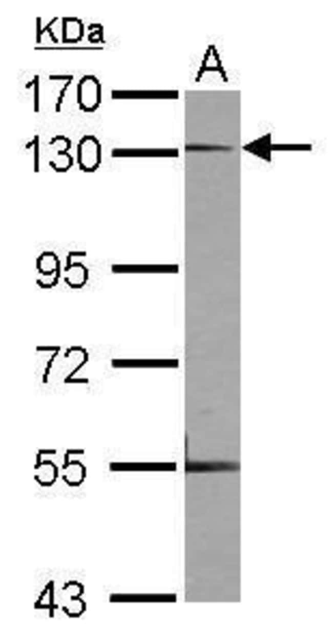 Anti-Neuropilin 1