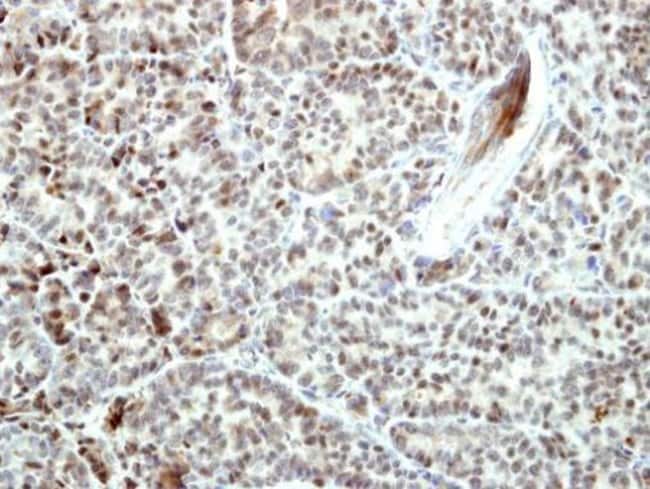 Anti-Bcl-B