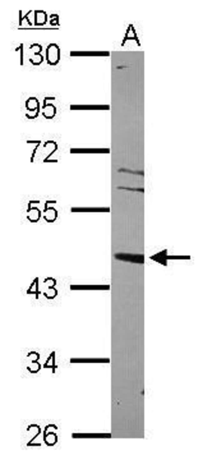 Anti-LXR alpha