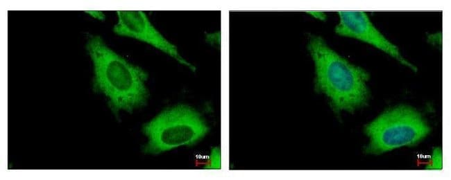 Anti-IGF2BP2