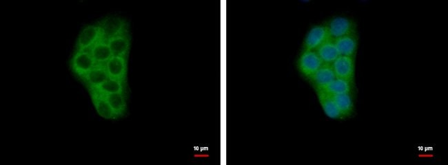 ANTI-CALCIUM BINDING PROTEIN P22