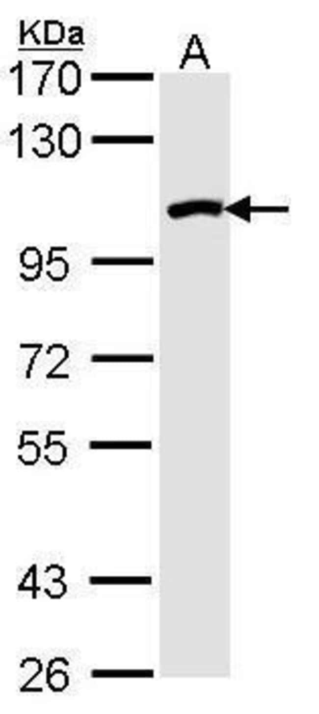 Anti-RAD54B