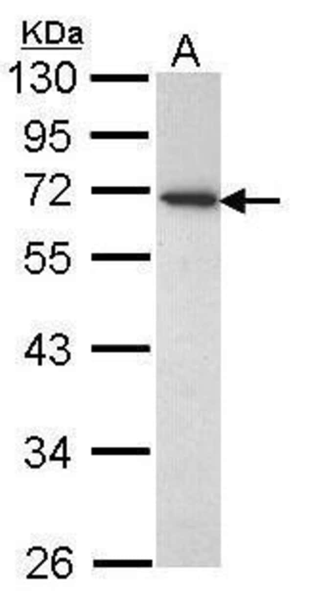 Anti-CD177