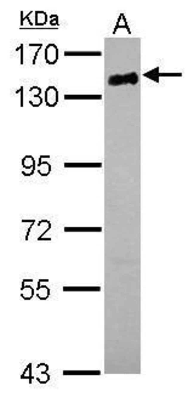 Anti-CD22