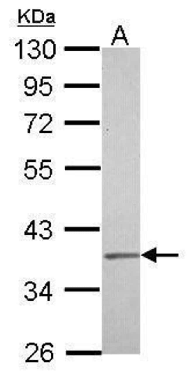 Anti-IGBP1