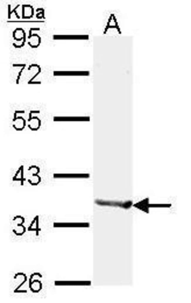 Anti-Alcohol dehydrogenase 1B