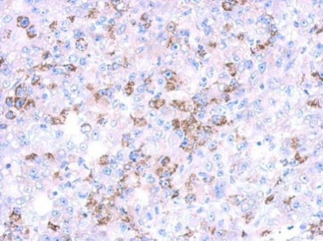 Anti-CYP27A1