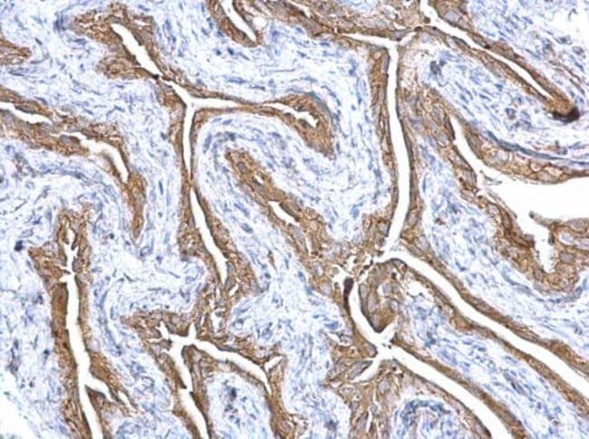 Anti-Gelsolin