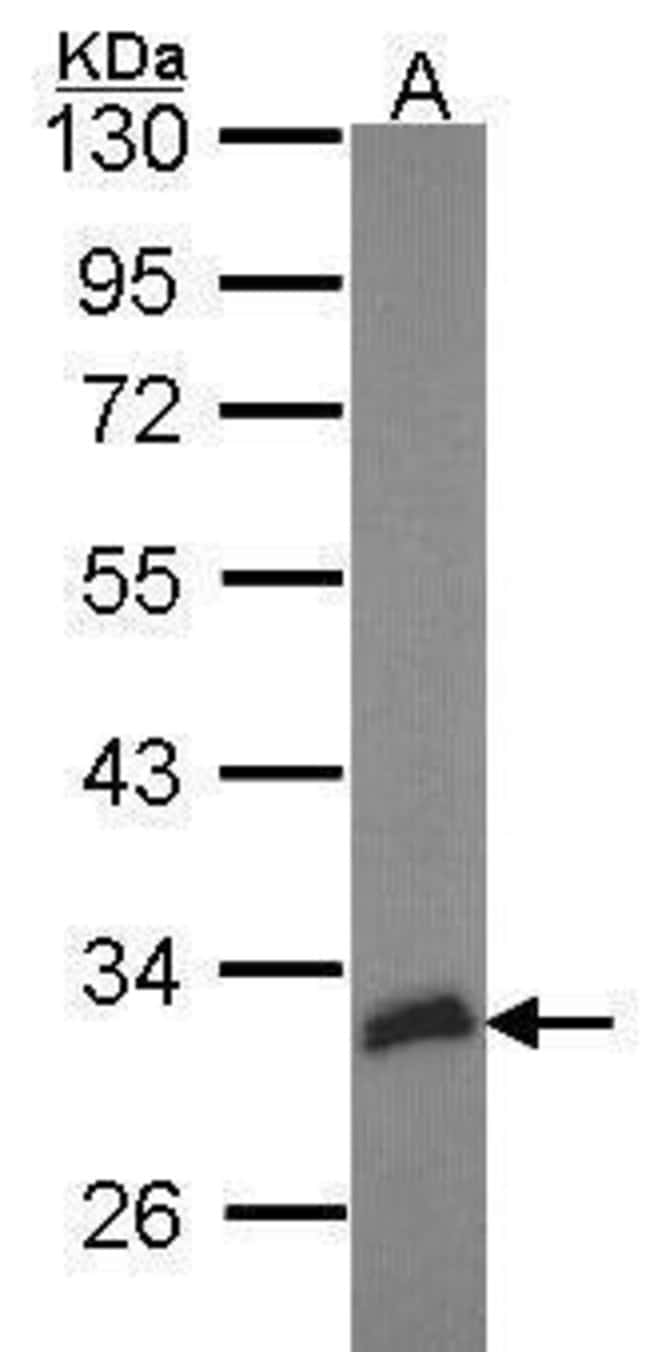 Anti-HEYL