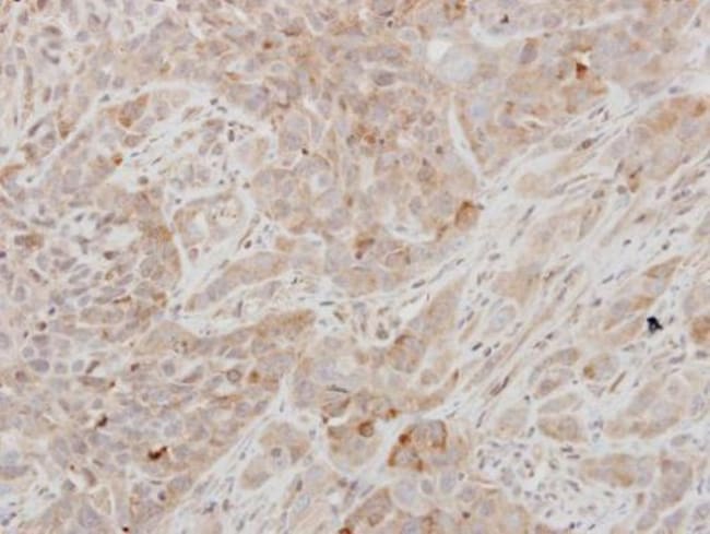 Anti-Prolactin