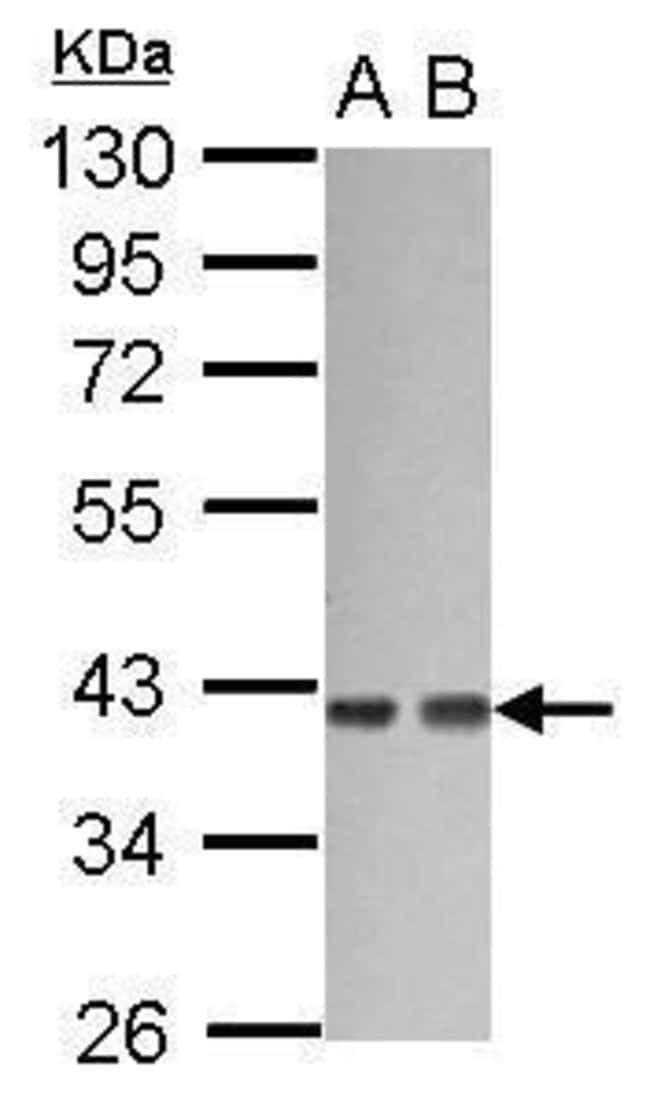 Anti-G protein alpha 12
