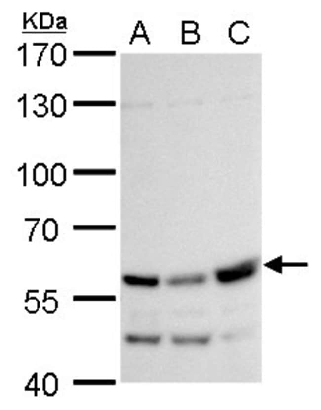 Anti-Rhotekin