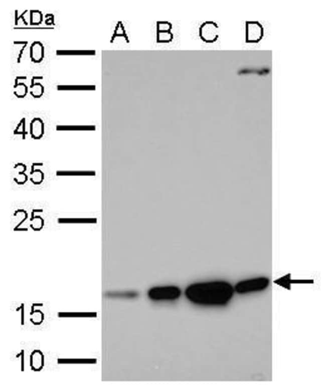 Anti-Destrin