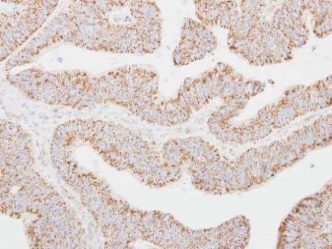 Anti-NNT-1/BSF-3