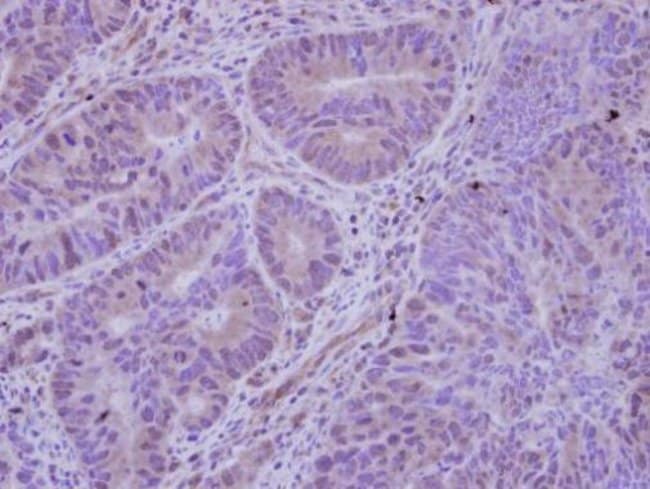 Anti-HDAC7