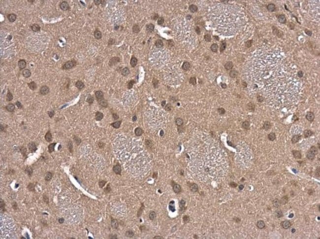 Anti-Glutathione reductase