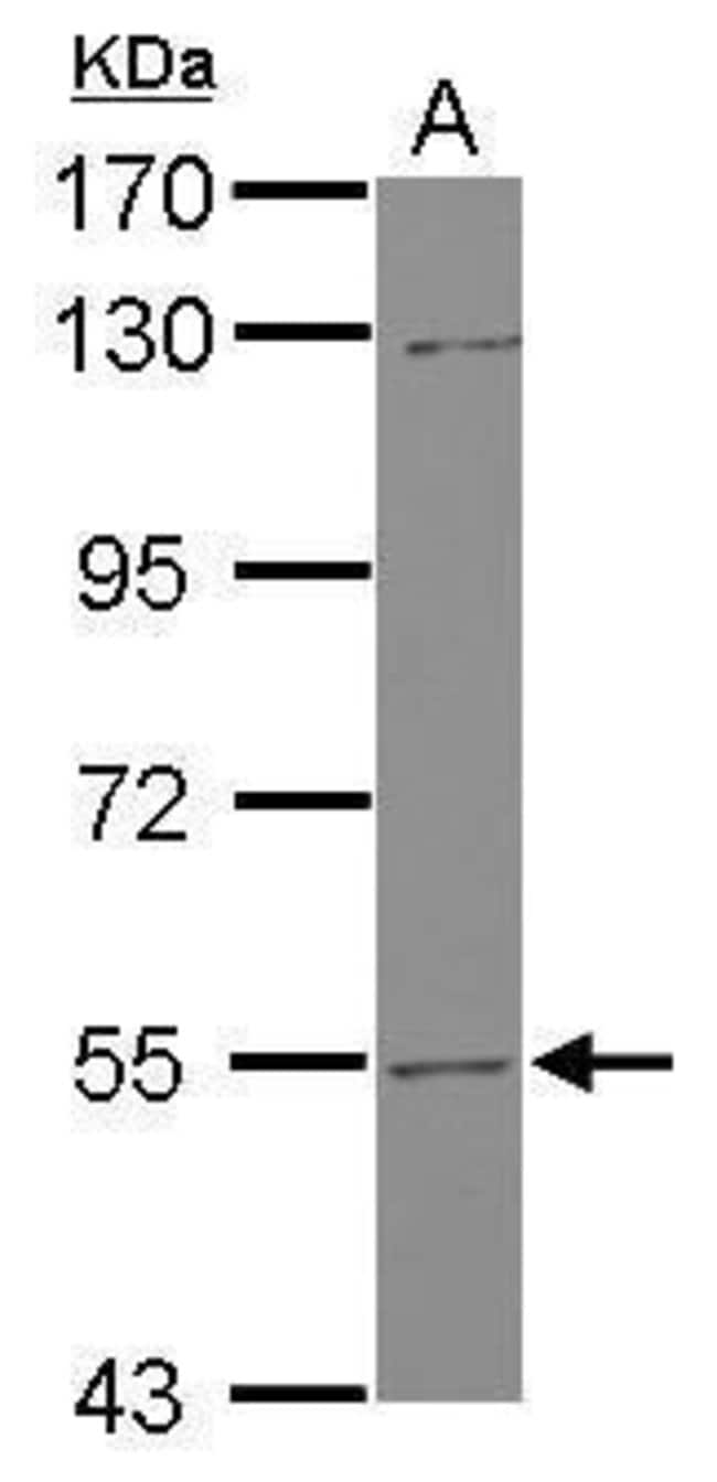 Anti-UGT2B7