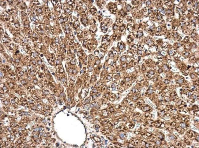 Anti-Radixin