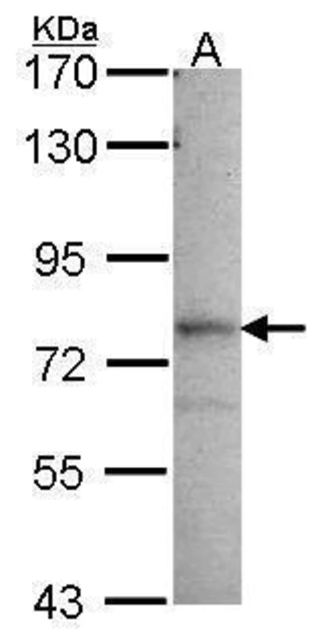 Anti-GMP synthase