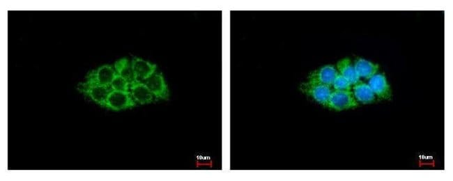 Anti-ACAA1
