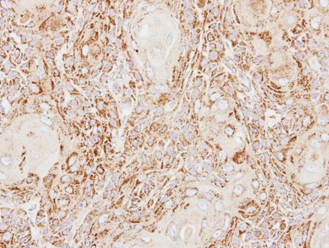 Anti-ACP2