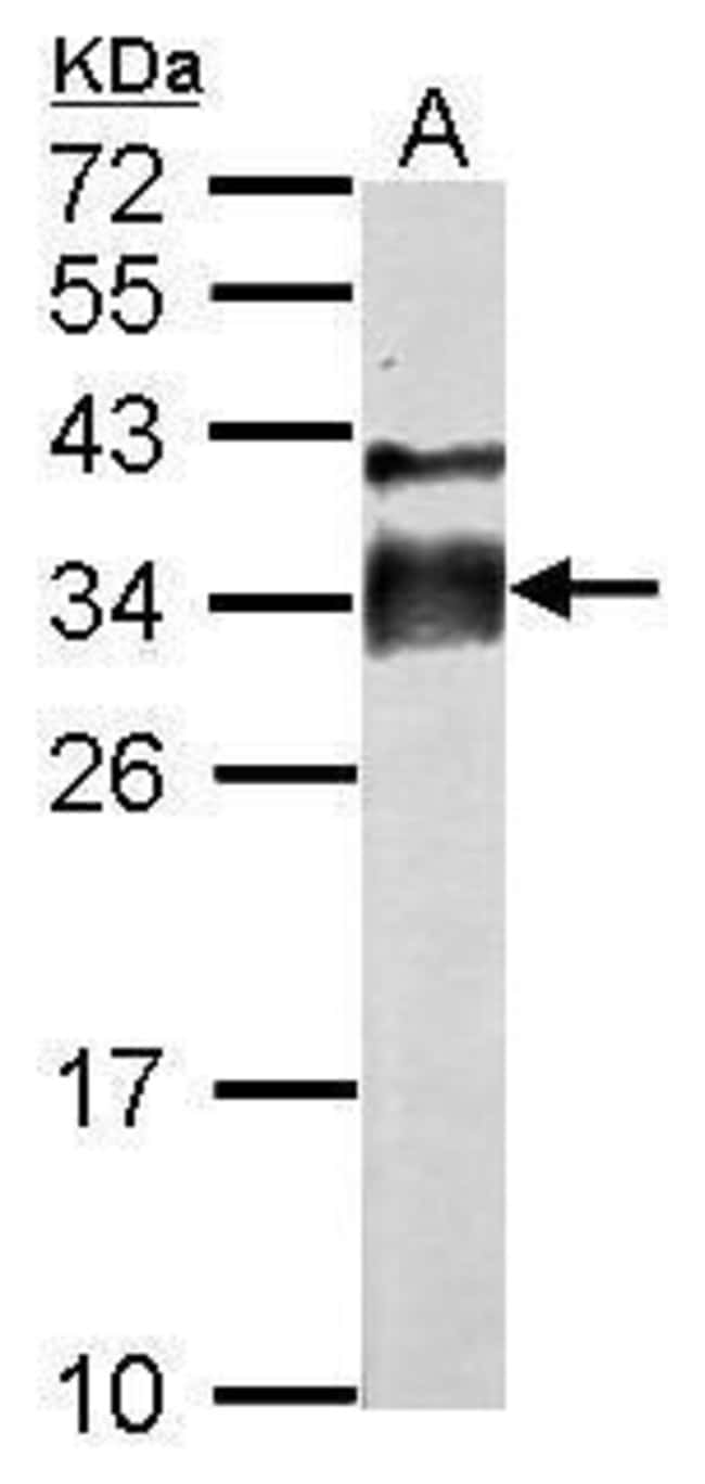 ANTI-ACROSOMAL VESICLE PROTEIN