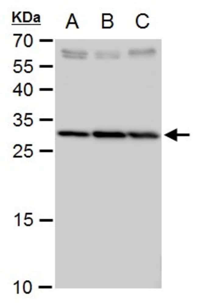 Anti-SLC25A6