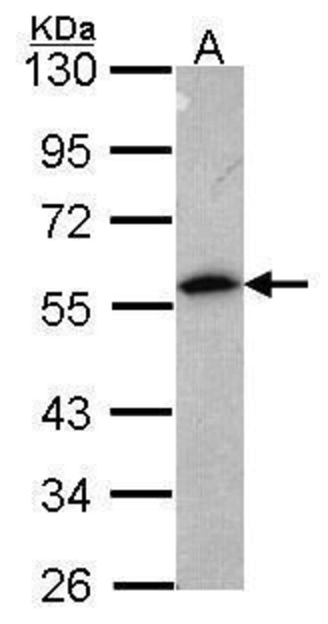 Anti-Annexin A11