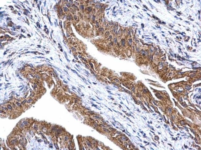 Anti-ATP synthase gamma