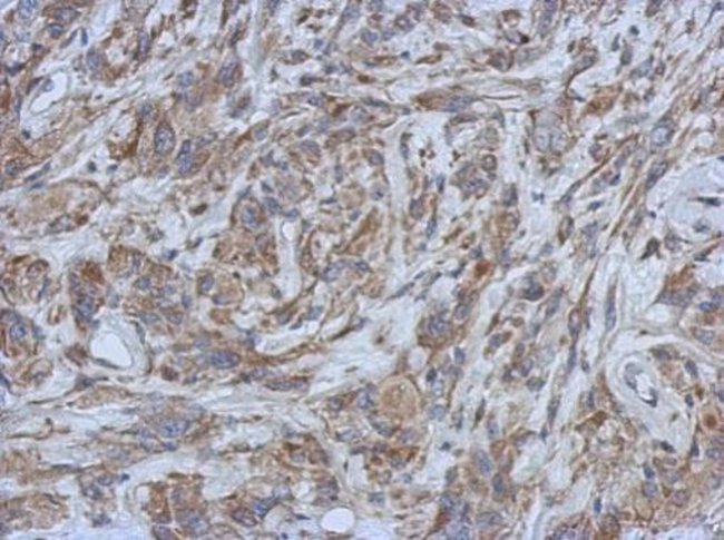 Anti-Filensin
