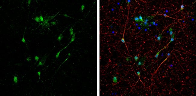 Anti-BNIP2