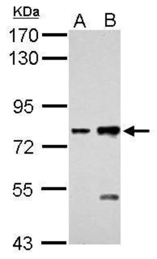 Anti-K cadherin