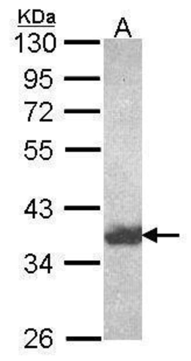 Anti-HSD3a
