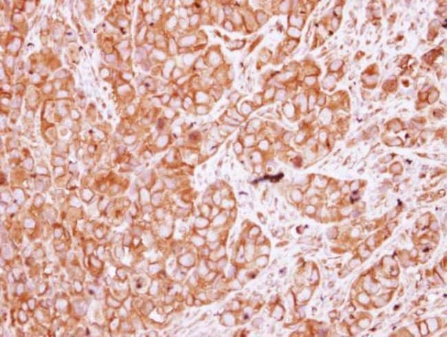 ANTI-NICOTINIC ACETYLCHOLINE RECEPTOR BE