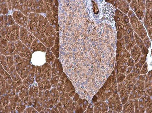 Anti-Carboxypeptidase B