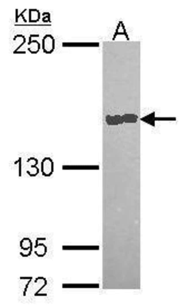 Anti-Carboxypeptidase D