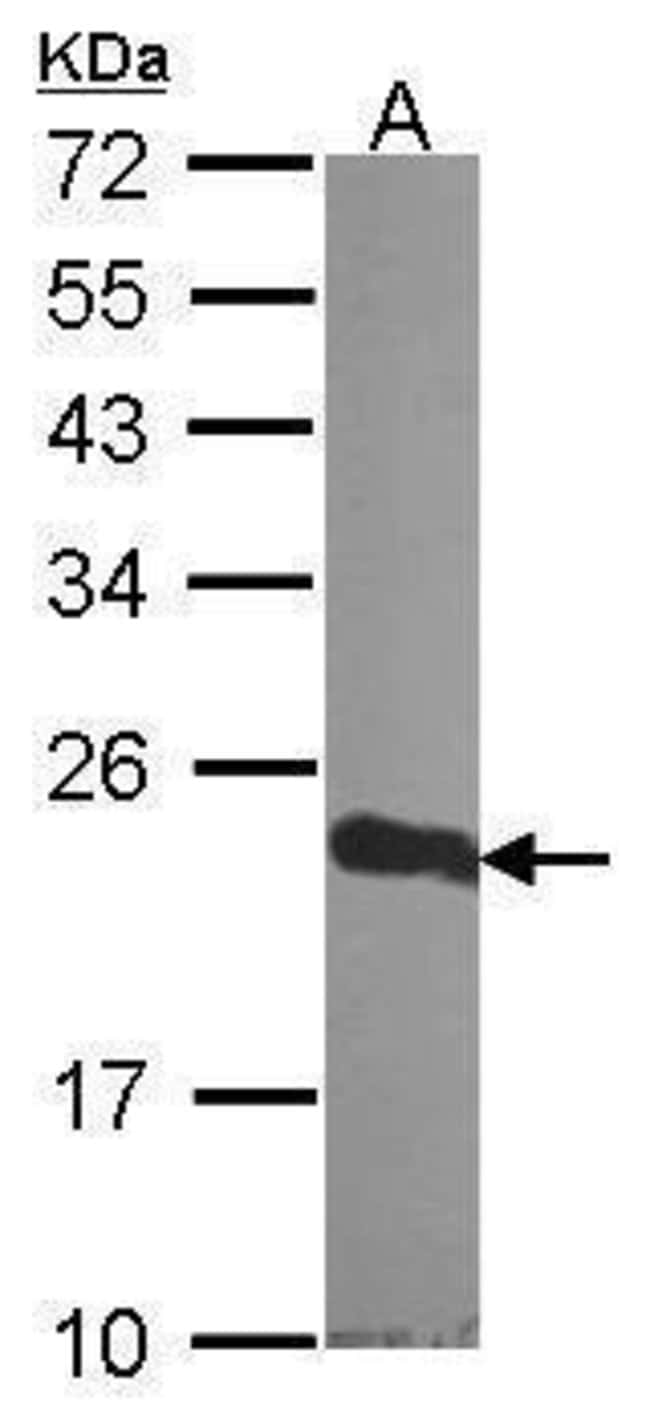 Anti-CRP1