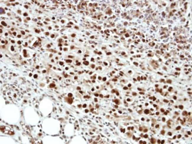 ANTI-CLEAVAGE STIMULATION FACTOR