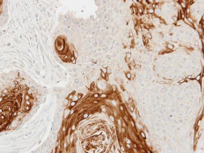 Anti-Cathepsin S