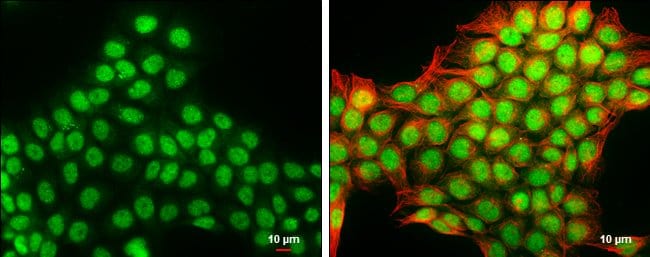 Anti-DNase IL3